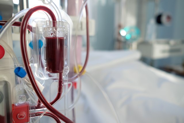 Niški Klinički centar zamenjuje sve aparate za hemodijalizu